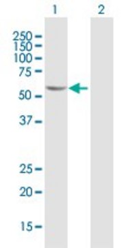 Anti-FGD5 antibody produced in mouse purified immunoglobulin, buffered aqueous solution