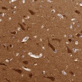 Anti-MYO5A antibody produced in rabbit Prestige Antibodies® Powered by Atlas Antibodies, affinity isolated antibody, buffered aqueous glycerol solution