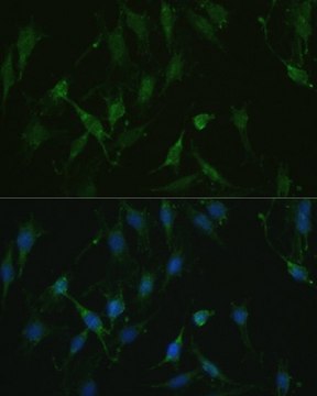 Anti-TRPV1 antibody produced in rabbit