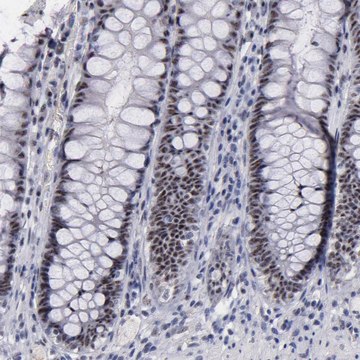 Anti-RAF1 antibody produced in rabbit Prestige Antibodies&#174; Powered by Atlas Antibodies, affinity isolated antibody, buffered aqueous glycerol solution