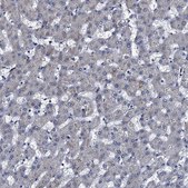 Anti-METTL4 antibody produced in rabbit Prestige Antibodies® Powered by Atlas Antibodies, affinity isolated antibody, buffered aqueous glycerol solution