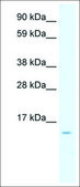 Anti-CCL7 antibody produced in rabbit affinity isolated antibody