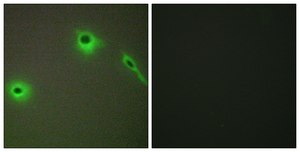Anti-Collagen XVIII α1 antibody produced in rabbit affinity isolated antibody