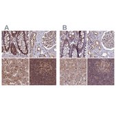 Anti-PSMB8 antibody produced in rabbit Prestige Antibodies® Powered by Atlas Antibodies, affinity isolated antibody, buffered aqueous glycerol solution