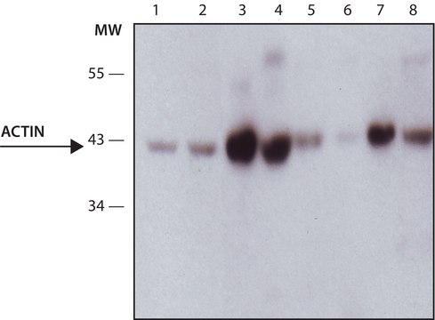 Anti-Actin, Muscle specific antibody, Mouse monoclonal clone HHF-35, purified from hybridoma cell culture