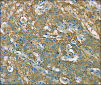 Anti-CSMD1 antibody produced in rabbit affinity isolated antibody