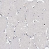 Anti-TDRD7 antibody produced in rabbit Prestige Antibodies® Powered by Atlas Antibodies, affinity isolated antibody, buffered aqueous glycerol solution