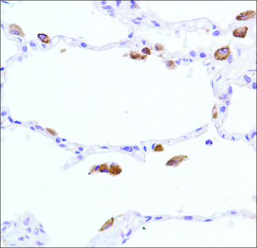 Anti-INOS antibody, Rabbit monoclonal clone SP126, recombinant, expressed in proprietary host, affinity isolated antibody