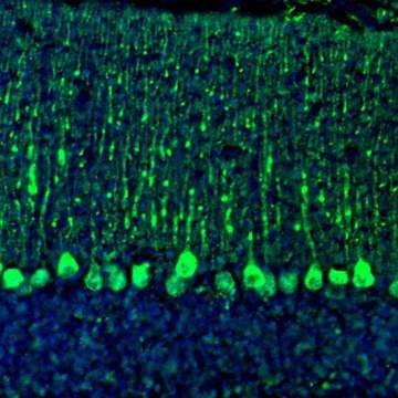 Anti-C21orf59 antibody produced in rabbit Prestige Antibodies&#174; Powered by Atlas Antibodies, affinity isolated antibody, buffered aqueous glycerol solution