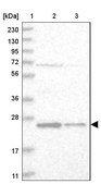 Anti-VBP1 antibody produced in rabbit Prestige Antibodies® Powered by Atlas Antibodies, affinity isolated antibody, buffered aqueous glycerol solution