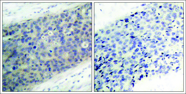 Anti-phospho-LIMK2 (pThr505) antibody produced in rabbit affinity isolated antibody