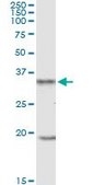 Anti-UCP2 antibody produced in mouse IgG fraction of antiserum, buffered aqueous solution
