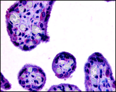 Anti-SLC7A5 (AB1) antibody produced in rabbit affinity isolated antibody, buffered aqueous solution