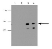 Anti-MMP13 antibody produced in rabbit affinity isolated antibody