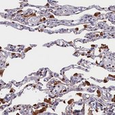 Anti-CRIP1 antibody produced in rabbit Prestige Antibodies® Powered by Atlas Antibodies, affinity isolated antibody, buffered aqueous glycerol solution