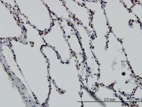 Monoclonal Anti-VDR antibody produced in mouse clone 2F4, purified immunoglobulin, buffered aqueous solution