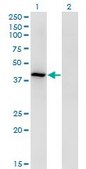 Monoclonal Anti-TMOD3, (C-terminal) antibody produced in mouse clone 1E1, purified immunoglobulin, buffered aqueous solution