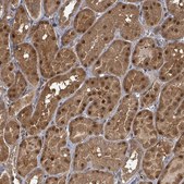 Anti-KDM4E antibody produced in rabbit Prestige Antibodies® Powered by Atlas Antibodies, affinity isolated antibody, buffered aqueous glycerol solution