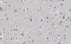 Anti-Tau Antibody, clone Tau 12 ZooMAb® Mouse Monoclonal recombinant, expressed in HEK 293 cells