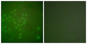 Anti-RAD17 antibody produced in rabbit affinity isolated antibody
