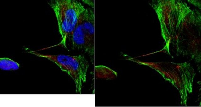 Anti-CD133 (Prominin-1) Antibody, clone 17A6.1 clone 17A6.1, from mouse