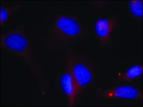 Anti-phospho-ZAP70 (pTyr319) antibody produced in rabbit affinity isolated antibody