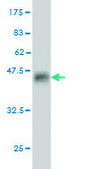 ANTI-RARA antibody produced in mouse clone 1C10, purified immunoglobulin, buffered aqueous solution