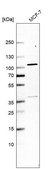 Anti-TELO2 antibody produced in rabbit Prestige Antibodies® Powered by Atlas Antibodies, affinity isolated antibody, buffered aqueous glycerol solution