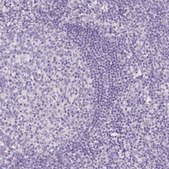 Anti-RNF186 antibody produced in rabbit Prestige Antibodies® Powered by Atlas Antibodies, affinity isolated antibody, buffered aqueous glycerol solution