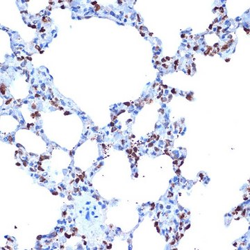 Anti-ADAM15 antibody produced in rabbit