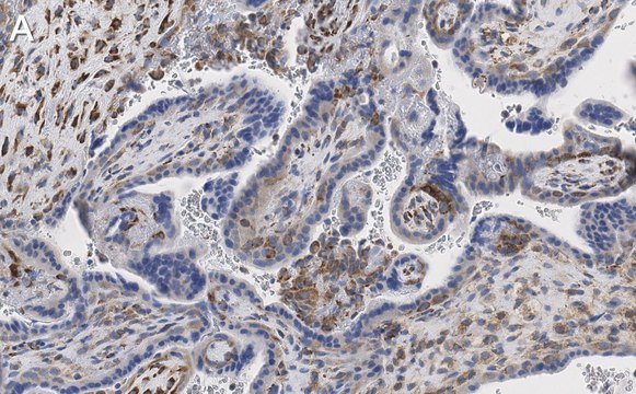 Anti-P4HA1 Antibody, clone 1C14 ZooMAb&#174; Rabbit Monoclonal recombinant, expressed in HEK 293 cells