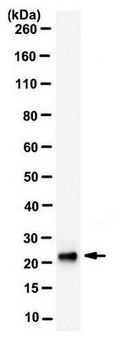 Anti-Troponin I Antibody, clone 5C11.1 clone 5C11.1, from mouse