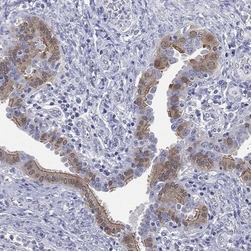 Anti-Ift27 Antibody Produced In Rabbit Prestige Antibodies® Powered by Atlas Antibodies, affinity isolated antibody, buffered aqueous glycerol solution