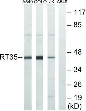 Anti-MRPS35 antibody produced in rabbit affinity isolated antibody