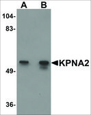 Anti-KPNA2 antibody produced in rabbit affinity isolated antibody, buffered aqueous solution