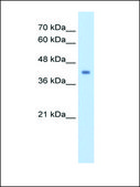 Anti-GCDH antibody produced in rabbit IgG fraction of antiserum