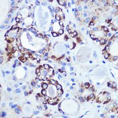 Anti- HK1 antibody produced in rabbit