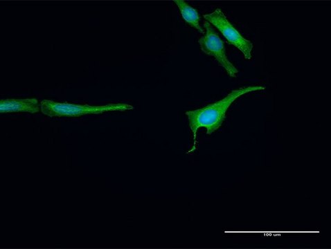 Anti-RNF14 antibody produced in rabbit purified immunoglobulin, buffered aqueous solution