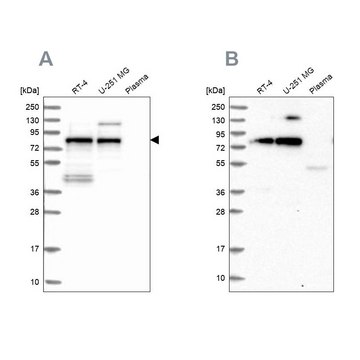 Anti-TNIP1 antibody produced in rabbit Prestige Antibodies&#174; Powered by Atlas Antibodies, affinity isolated antibody, buffered aqueous glycerol solution