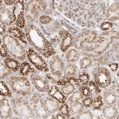 Anti-SLC25A26 antibody produced in rabbit Prestige Antibodies® Powered by Atlas Antibodies, affinity isolated antibody, buffered aqueous glycerol solution