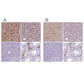 Anti-APOE antibody produced in rabbit Prestige Antibodies® Powered by Atlas Antibodies, affinity isolated antibody, buffered aqueous glycerol solution