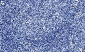 Anti-B7-H3/CD276 Antibody, clone 2E22 ZooMAb® Rabbit Monoclonal recombinant, expressed in HEK 293 cells