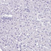 Anti-PGM2L1 antibody produced in rabbit Prestige Antibodies® Powered by Atlas Antibodies, affinity isolated antibody, buffered aqueous glycerol solution