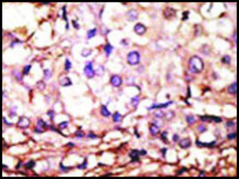 Anti-PRMT6 (N-term) antibody produced in rabbit saturated ammonium sulfate (SAS) precipitated, buffered aqueous solution