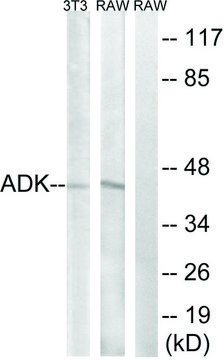 Anti-ADK antibody produced in rabbit affinity isolated antibody