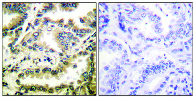 Anti-NF-&#954;B p65 (Acetyl-Lys310) antibody produced in rabbit affinity isolated antibody