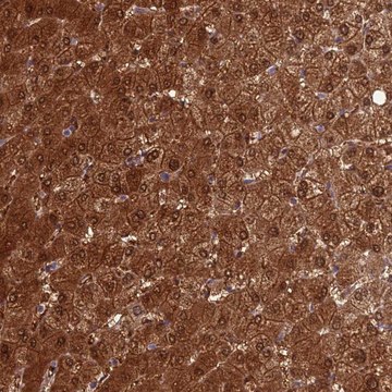 Anti-GNPNAT1 antibody produced in rabbit Prestige Antibodies&#174; Powered by Atlas Antibodies, affinity isolated antibody, buffered aqueous glycerol solution