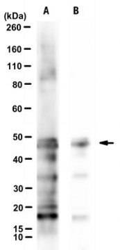 Anti-Nebulin Antibody, clone NEB-6B5