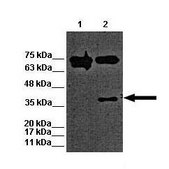 Anti-MBD2 antibody produced in rabbit affinity isolated antibody