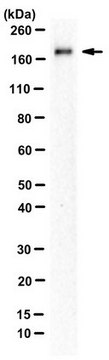 Anti-Slit2 Antibody, C-term from rabbit, purified by affinity chromatography